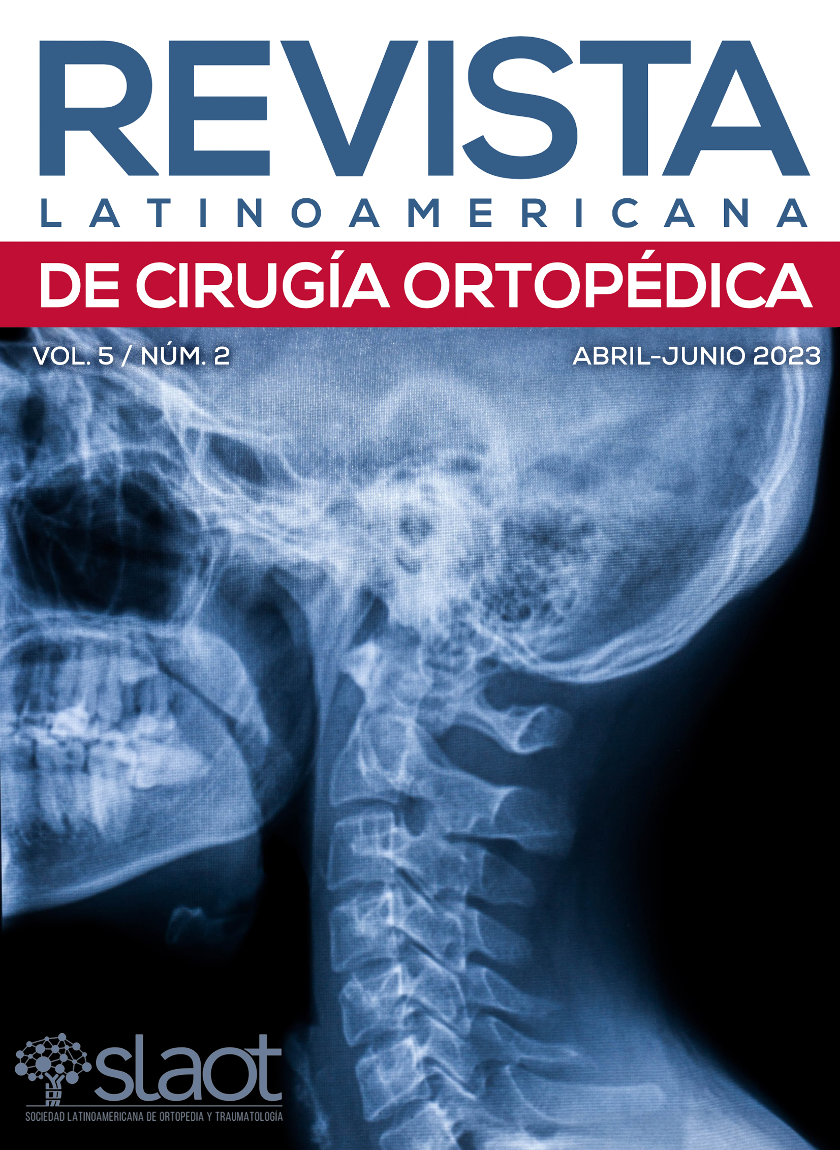 Revista Latinoamericana de Cirugía Ortopédica